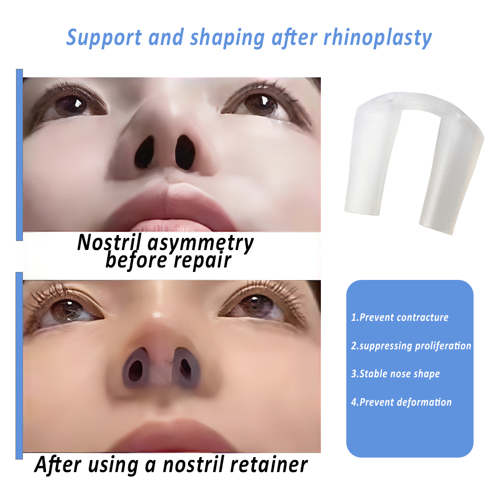 التجنيب الأنف لتمثيل الأنف بعد - مراجعة Anti Snore Contour Pillow وسعره